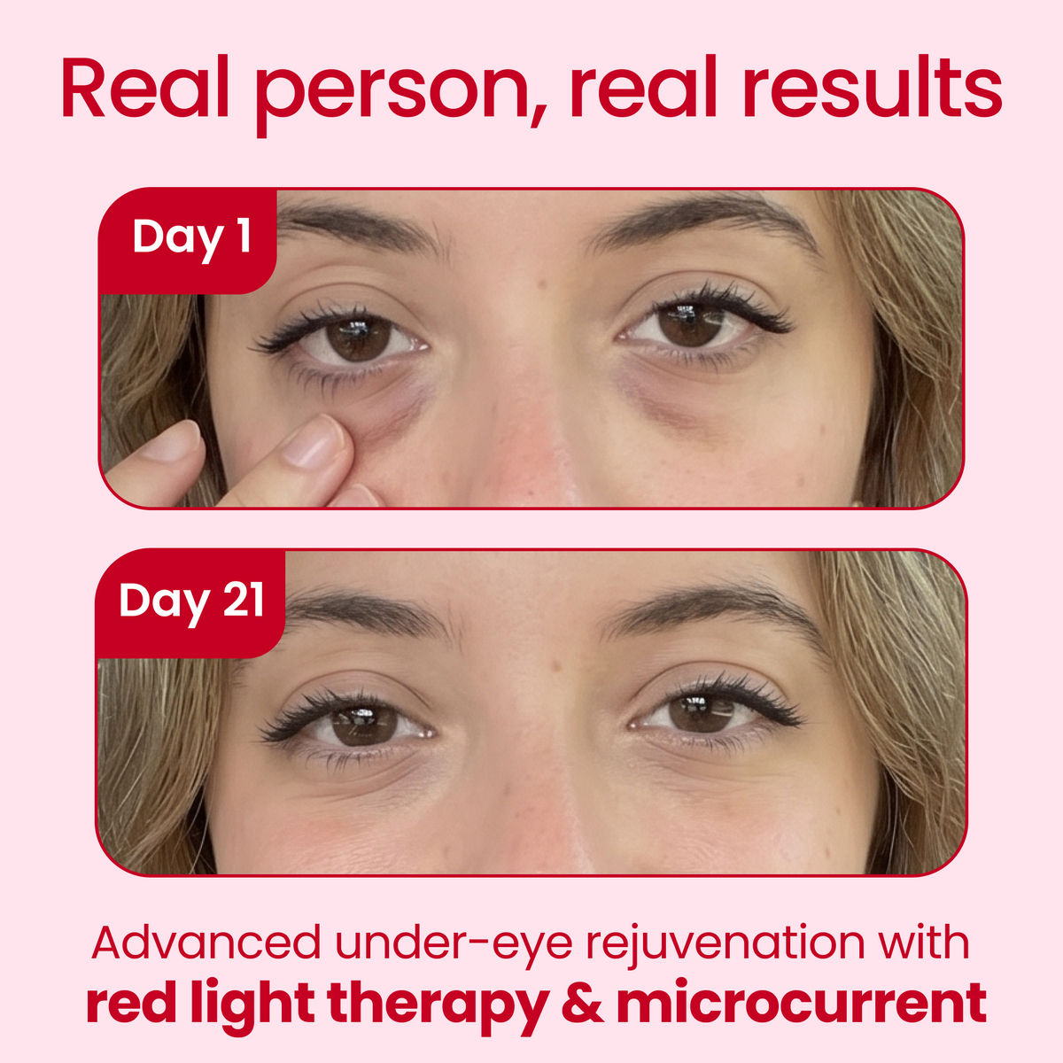 GlowlyLens Redlight + Microcurrent Glasses